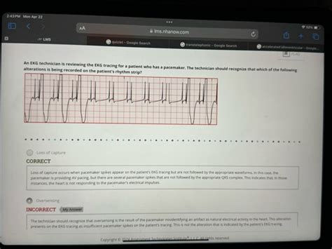 Afbeeldingsresultaten voor EKG Practice Test Questions