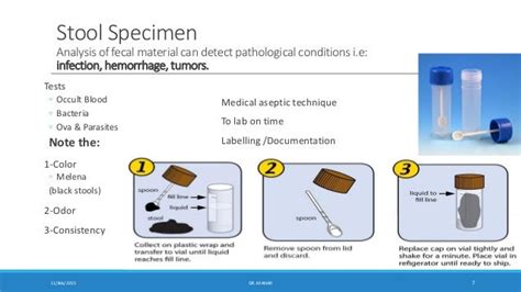 Résultat d’images pour Specimen Collection Nursing