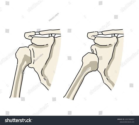 Toradh íomhá ar Dislocation Drawing