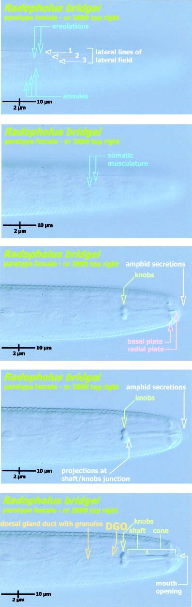 Image result for VCE Clip Tools