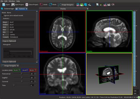 Image result for Simple ITK in MATLAB Code Example