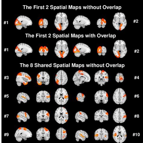 Image result for MRI Spatial Localization