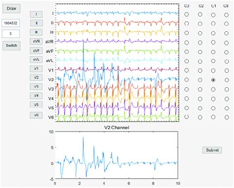 Image result for GUI Annotation