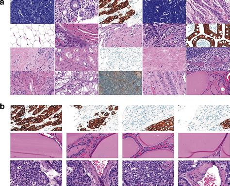 Image result for Mutli Class Classification Dataset