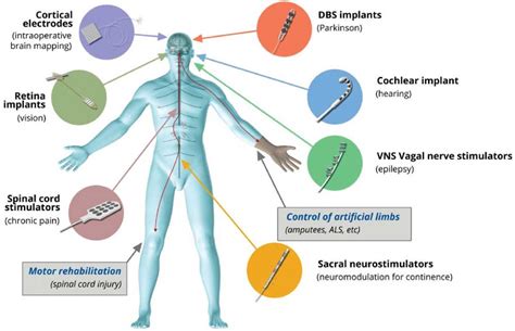 Afbeeldingsresultaten voor Neural Interface