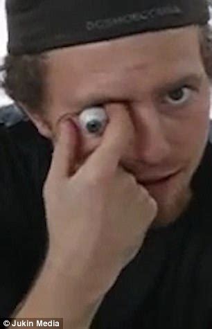 Image result for Eye Pops Out of Socket