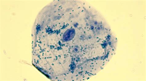 Image result for Human Cheek Cell Microscope