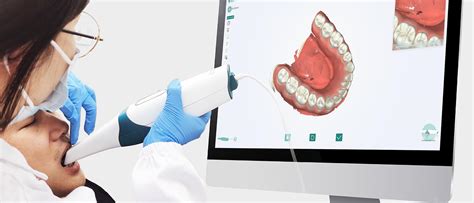 Image result for 3D Teeth Scanner