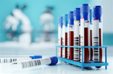 Image result for In Hospital Blood Lab Test