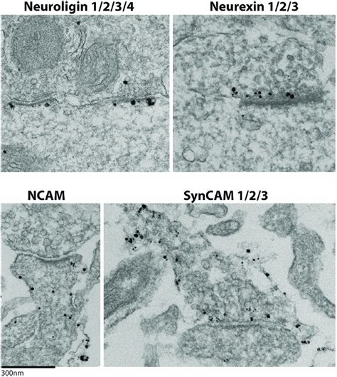 Image result for Focal Adhesion Image Electron Microscope