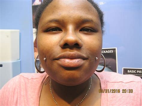 Image result for Cheek Dimples