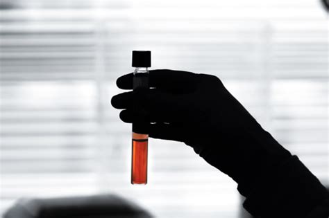 Image result for Naat Test-Tube