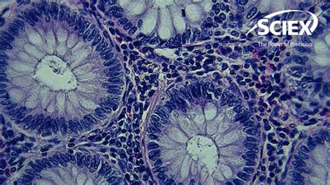 End to End Networks ਲਈ ਪ੍ਰਤੀਬਿੰਬ ਨਤੀਜਾ