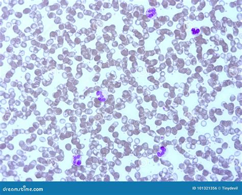 Image result for Blood Fluid Matrix Microscope