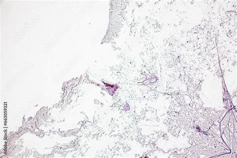 Neuron Section Cut Under Microscope కోసం చిత్ర ఫలితం
