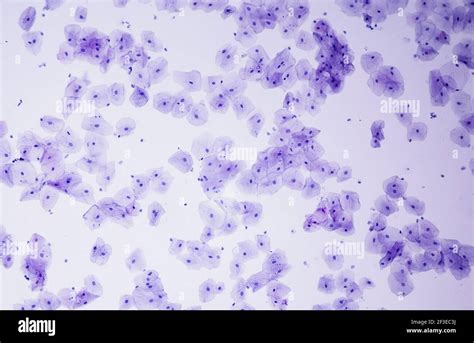 Image result for Human Cheek Cell Microscope