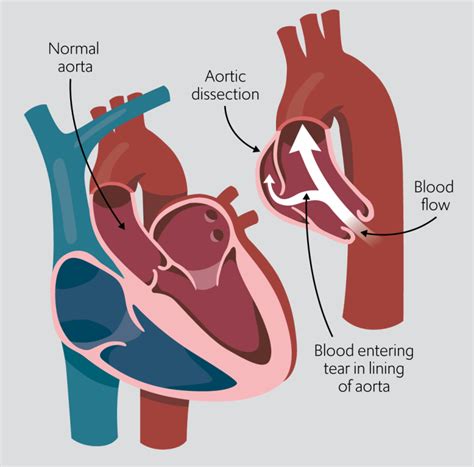 Medical Dissection に対する画像結果