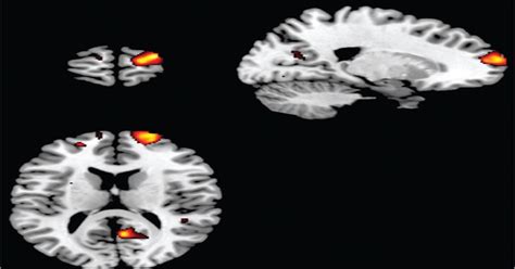 Image result for MRI Scanner Prefrontal Cortex