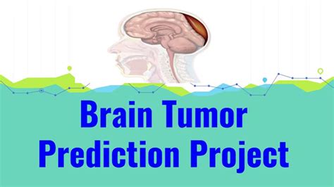 Résultat d’images pour Brain Tumor Detection Using Deep Learning
