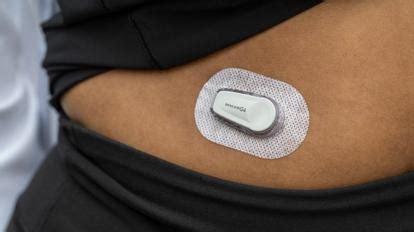 Afbeeldingsresultaten voor Dexcom Sensor Placement