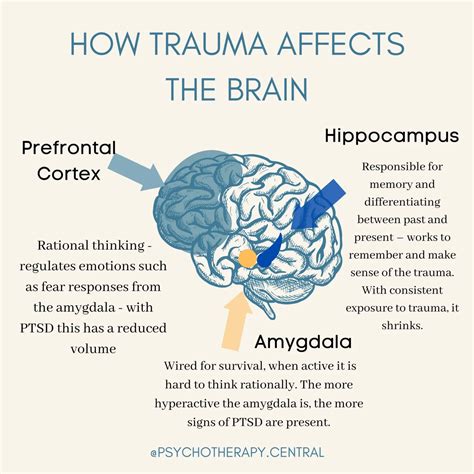 Image result for Types of Trauma Informed Interventions