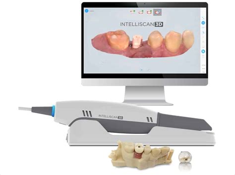 Image result for 3D Teeth Scanner
