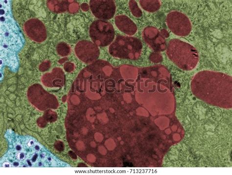 Image result for Electron Microscope False-Color
