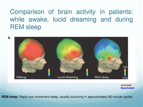 Image result for Sleep Brain Scan