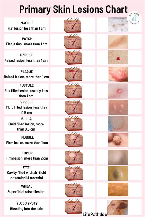 Toradh íomhá ar Sizes of Cutaneous Defect