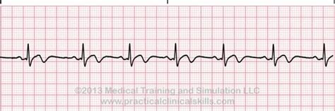 EKG Practice Test Quizlet に対する画像結果