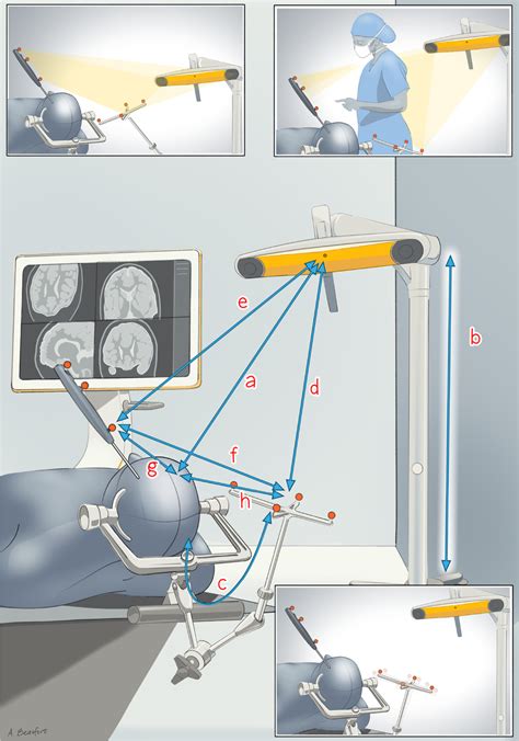 Image result for Cranial Reference Array