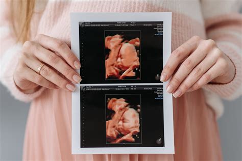 Image result for 3D/4D Ultrasound Exam