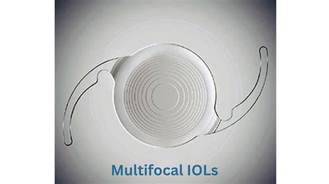 ClearVision Multifocal IOL に対する画像結果