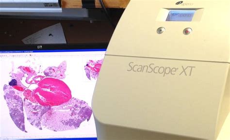 Tissue Microarray に対する画像結果