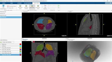 Image result for Medical Imaging Tool Box MATLAB LabVIEW