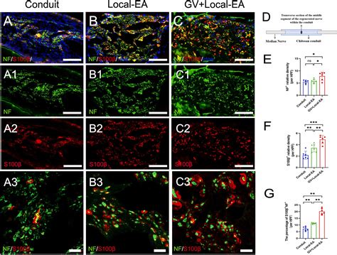 Afbeeldingsresultaten voor Nerve Conduit Transplantation