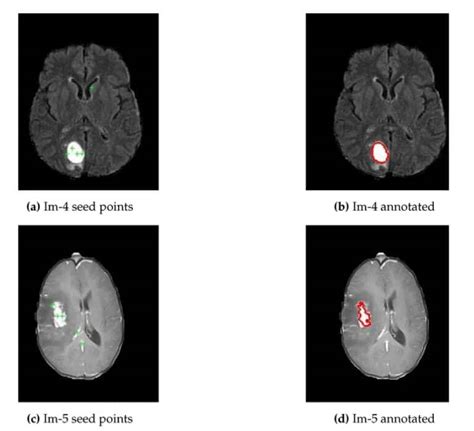 Image result for Machine Vision Segmentation