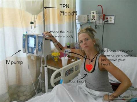 Toradh íomhá ar TPN PFP