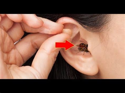 Toradh íomhá ar Bug Stuck in Ear