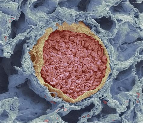 Toradh íomhá ar Vessel Operationalization