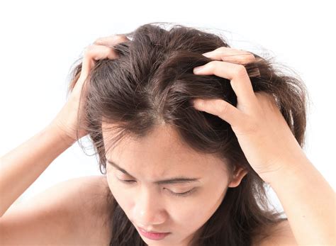 Itchy Rash On Scalp కోసం చిత్ర ఫలితం