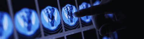 Image result for Is InteleConnect Web-Based