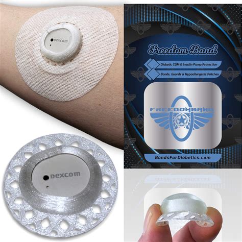 Dexcom Sensor On Arm માટે ઇમેજ પરિણામ