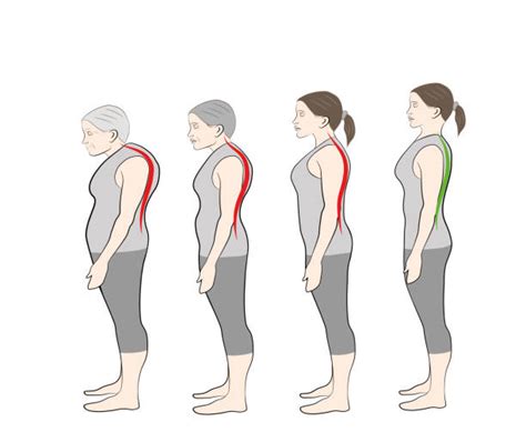 Image result for Stooped Posture Cartoon