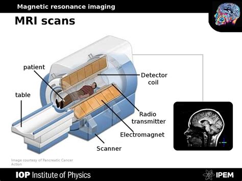 Image result for How Does MRI Work