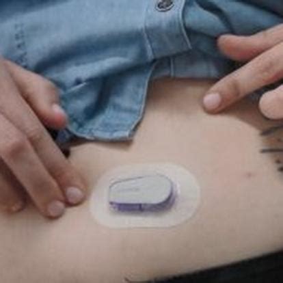 Image result for Dexcom Schematics