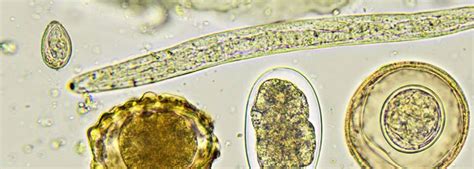 Image result for Parasitology Examples