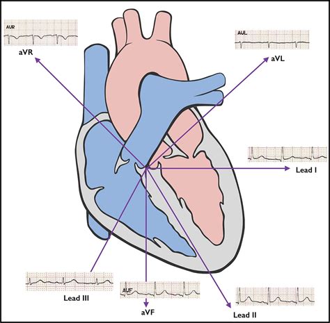 Afbeeldingsresultaten voor Normal ECG Trace