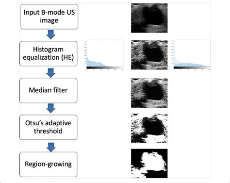 Afbeeldingsresultaten voor Histogram Equalization Flowchart