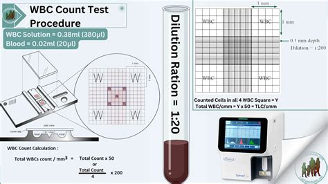 Image result for WBC Count